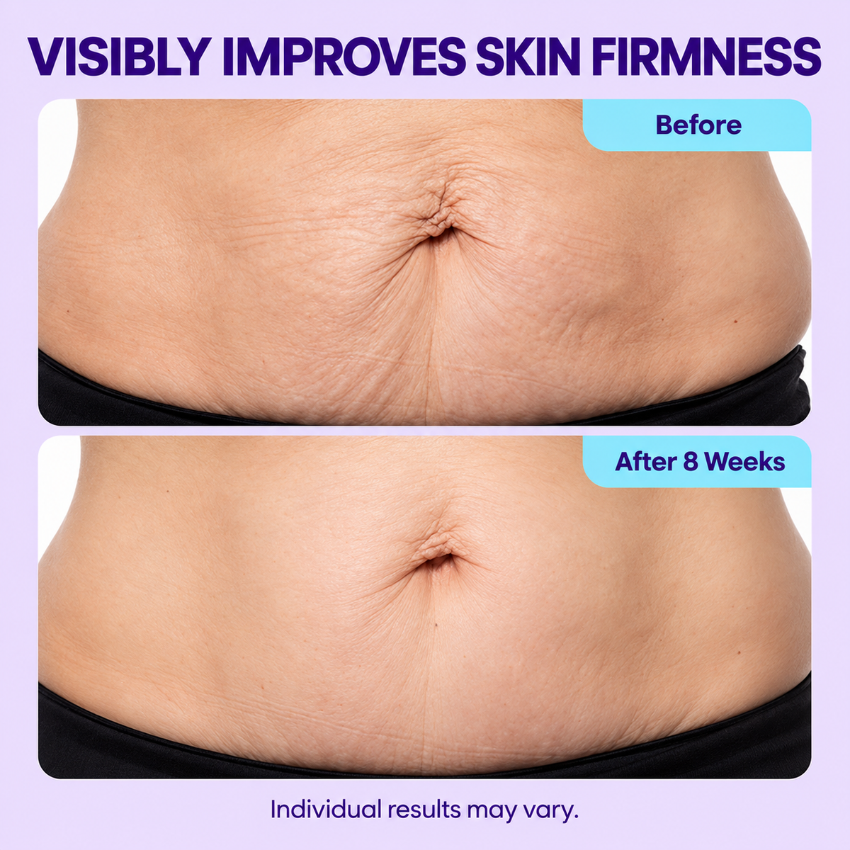 Tighten & Smooth Belly Cream