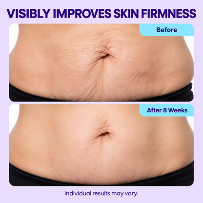 Tighten & Smooth Belly Cream